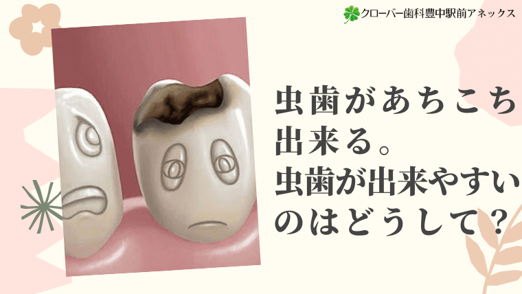 虫歯があちこち出来る。虫歯が出来やすいのはどうして？