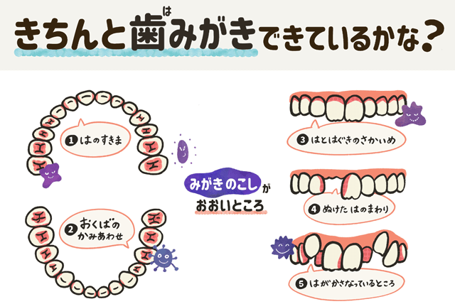 きちんと歯磨きできているかな？