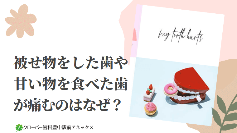 被せ物をした歯や甘い物を食べた歯が痛むのはなぜ？