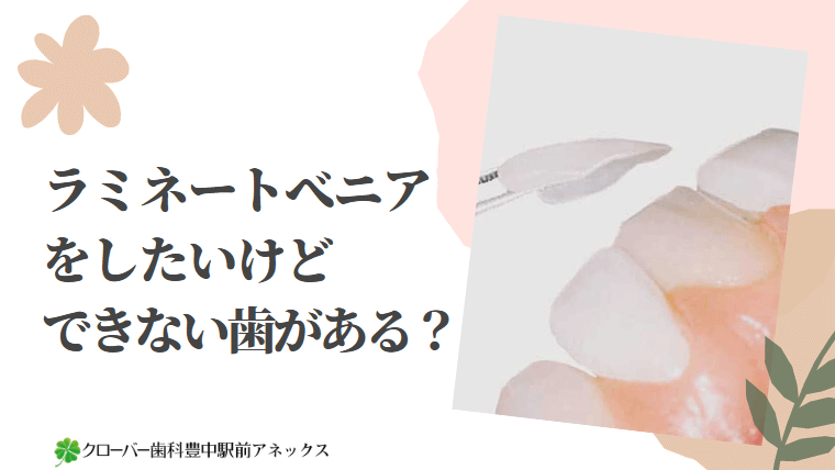 ラミネートべニアをしたいけどできない歯がある？