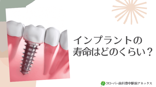 インプラントの寿命はどのくらい？