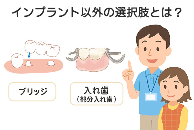 選択肢