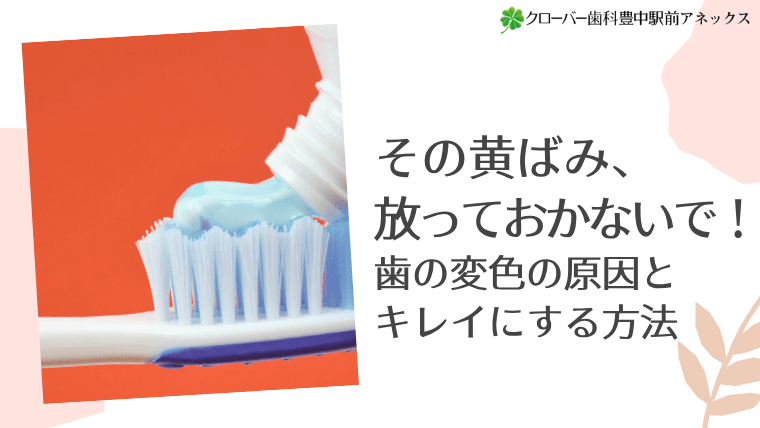その黄ばみ、放っておかないで!歯の変色の原因とキレイにする方法