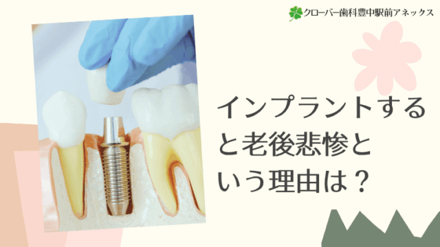 インプラントすると老後悲惨という理由は？