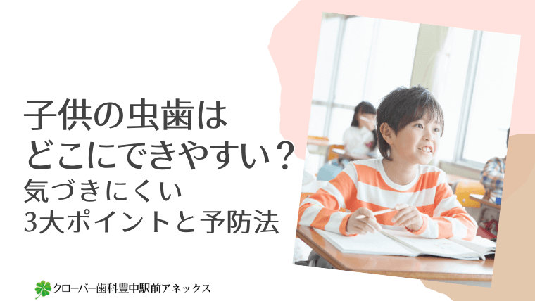 子供の虫歯はどこにできやすい?