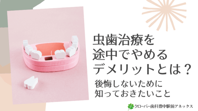 虫歯治療を途中でやめるデメリットとは？