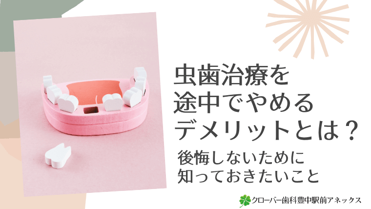 虫歯治療を途中でやめるデメリットとは?