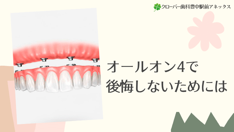 オールオン4で後悔しないためには
