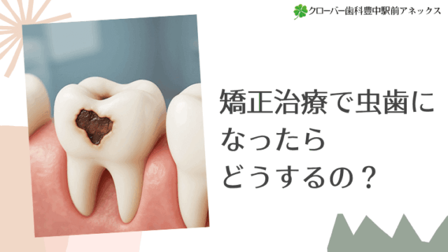 矯正治療で虫歯になったらどうするの？