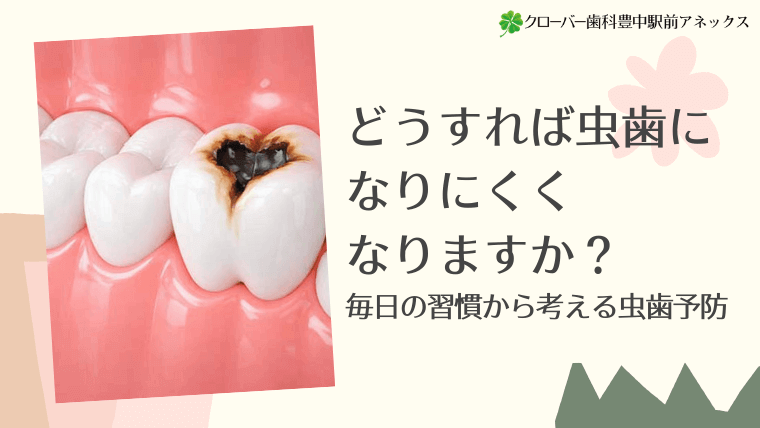 どうすれば虫歯になりにくくなりますか？毎日の習慣から考える虫歯予防