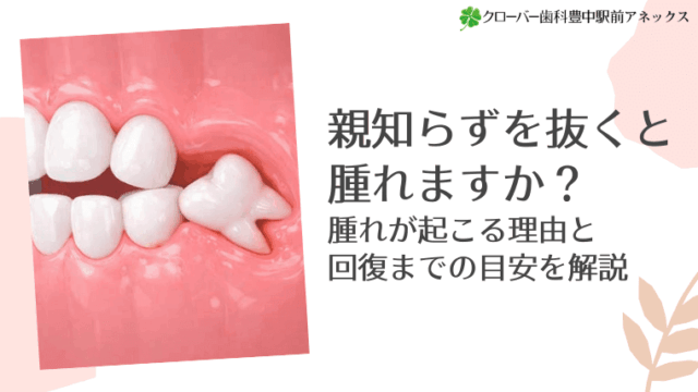 親知らずを抜くと腫れますか？腫れが起こる理由と回復までの目安を解説