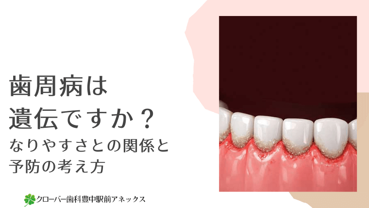 歯周病は遺伝ですか？なりやすさとの関係と予防の考え方