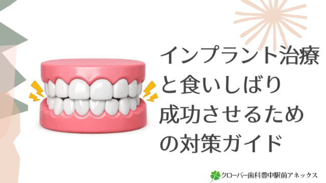 インプラント治療と食いしばり：成功させるための対策ガイド