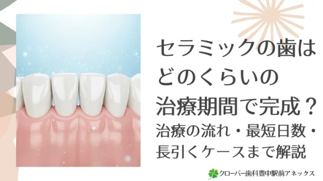 セラミックの歯はどのくらいの治療期間で完成？治療の流れ・最短日数・長引くケースまで解説