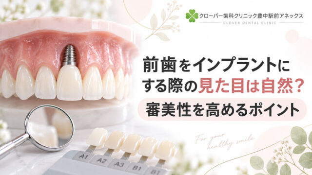 前歯をインプラントにする際の見た目は自然？審美性を高めるポイント