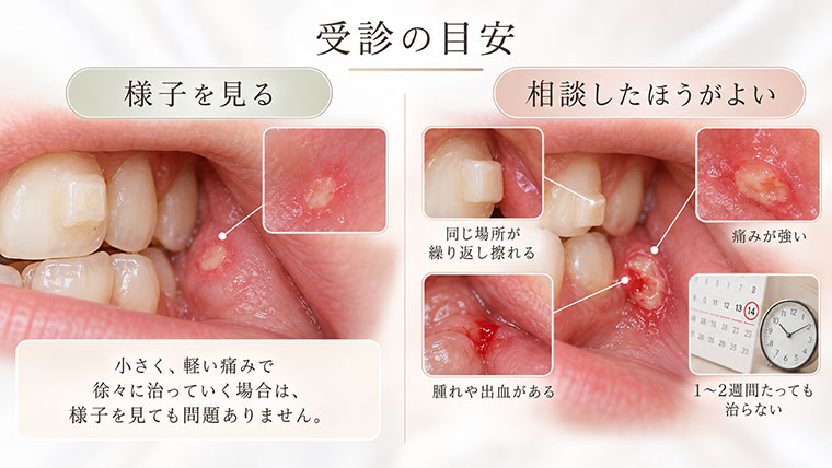 受診の目安