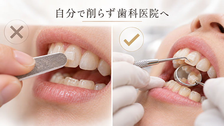 自分で削らず歯科医院へ