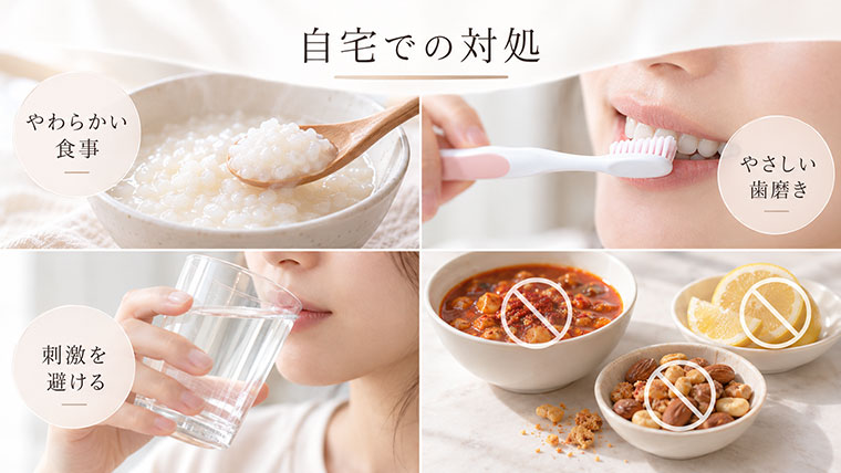 口内炎の自宅での対処