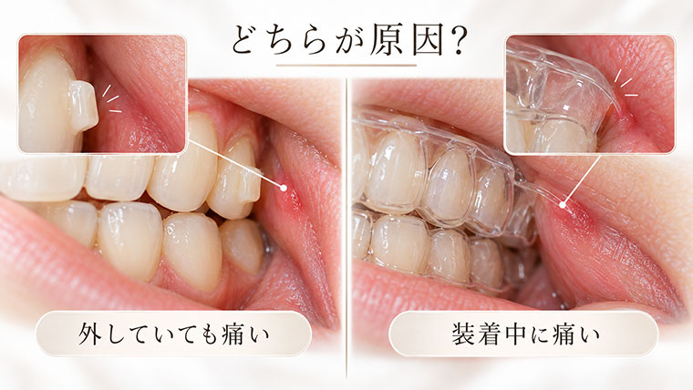 どちらが原因か